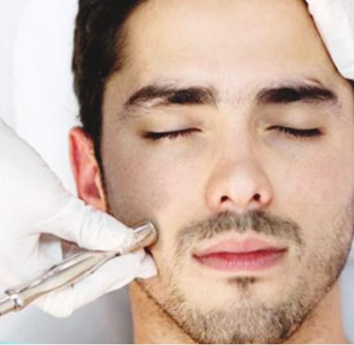 Microdermabrasion treatment at Derma Aesthetics Clinic Brentwood