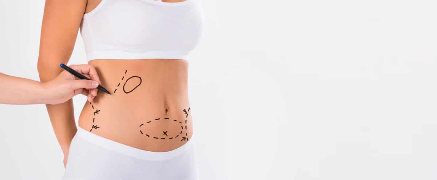 Aqualyx fat dissolving injections at Derma Aesthetics Clinic Brentwood