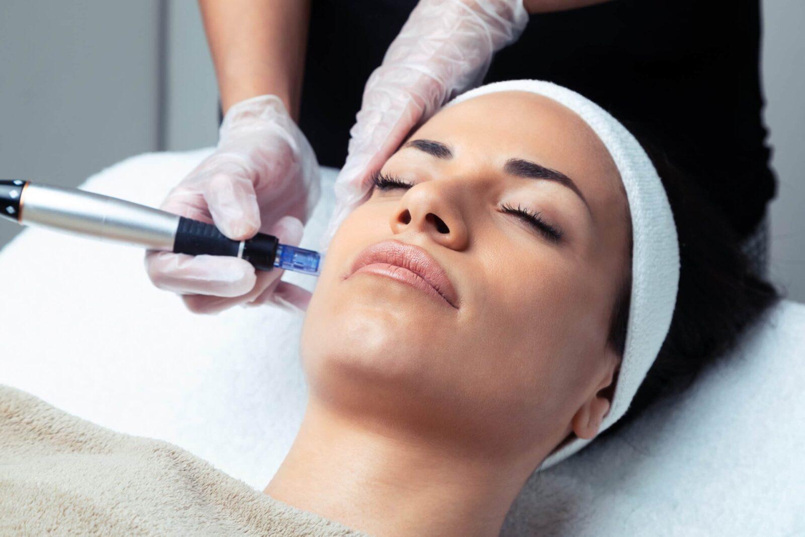 Dermapen microneedling at Derma Aesthetics Clinic Brentwood