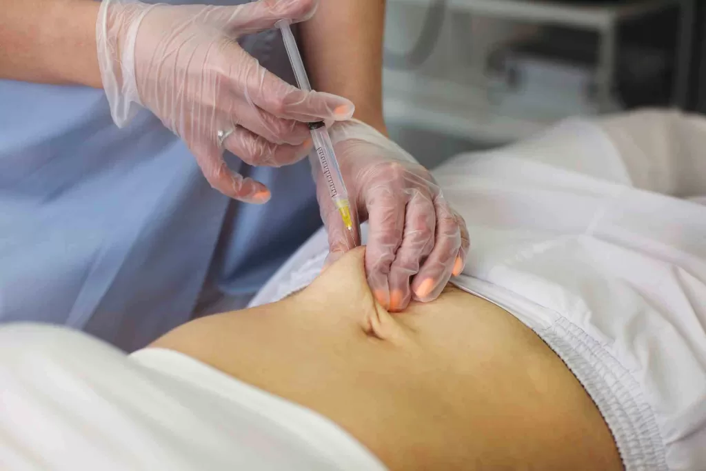 Lemon Bottle injectable body contouring treatment